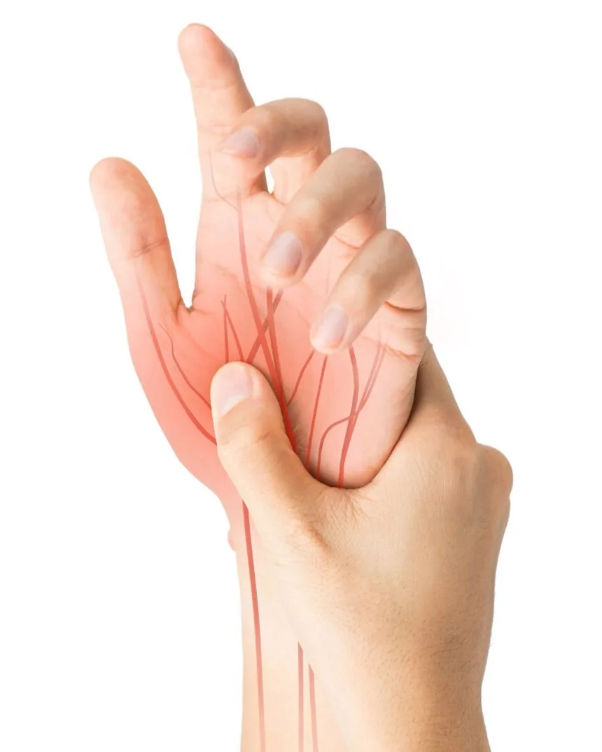 A hand held to show the path of an entrapped nerve