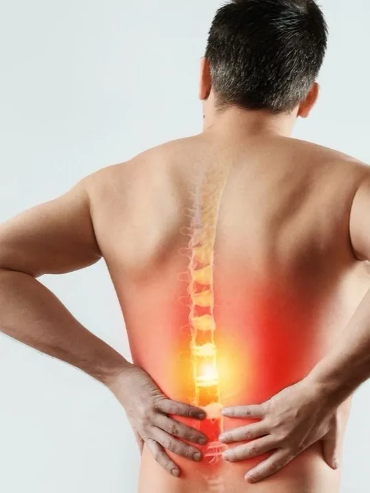 Sciatica — assessed and treated at Halcyon, Hyderabad